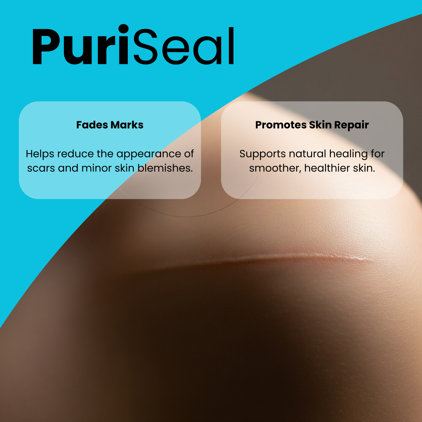PuriSeal Hydrocolloid Roll