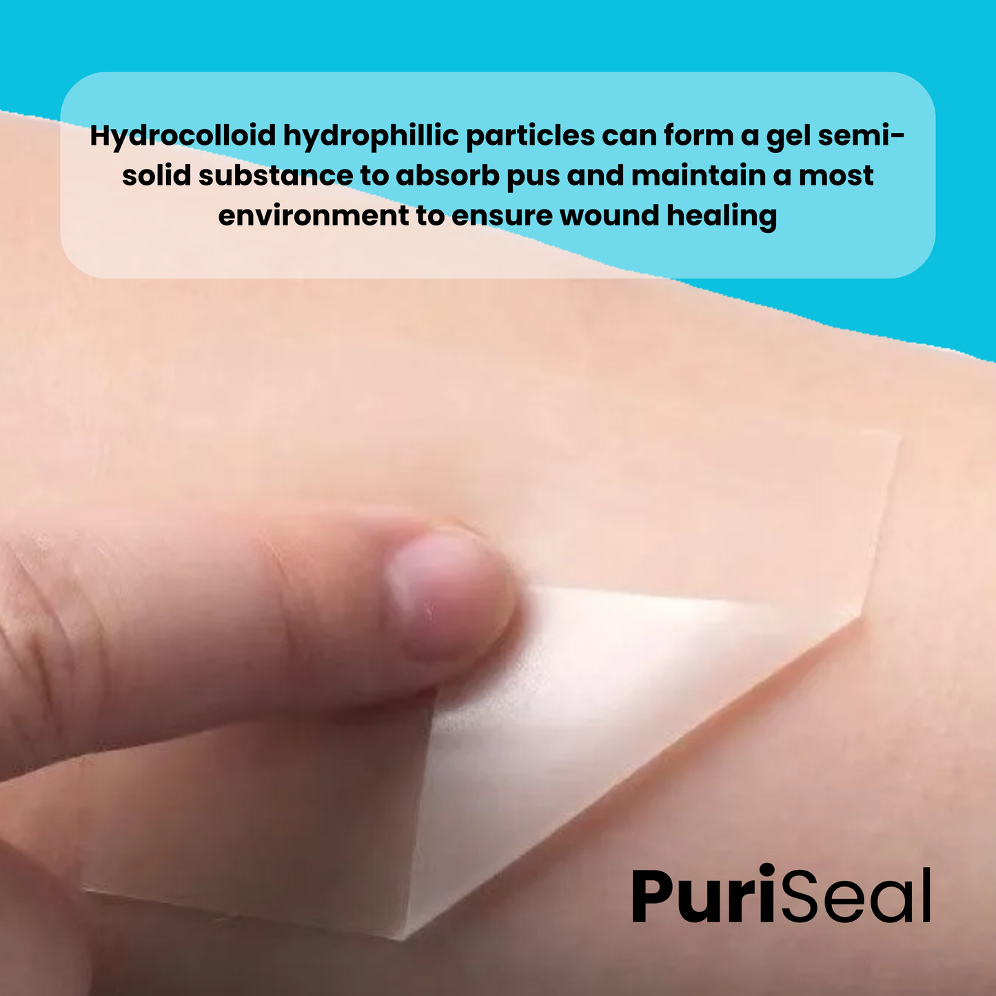 PuriSeal Hydrocolloid Roll